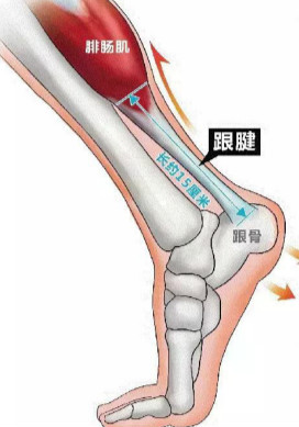 跟腱炎的治疗.jpg