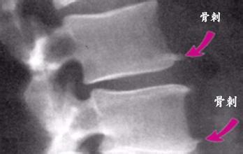 u=4086511523,1391678511&fm=21&gp=0 u=4086511523,1391678511&fm=21&gp=0